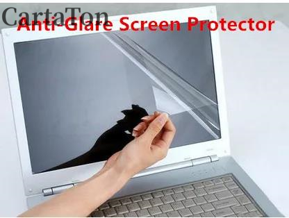2PCS Anti-Glare reflexion Matt – Anti Blue Light Film Bewertung und Preis